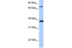 WB Suggested Anti-DIDO1 Antibody Titration:  0. (DIDO1 antibody  (C-Term))