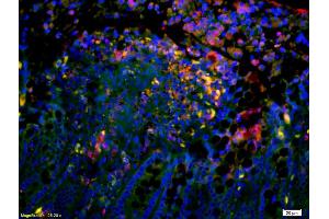 Formalin-fixed and paraffin-embedded mouse intestine labeled with Anti-Complement C4/C4 Polyclonal Antibody, Unconjugated (ABIN1385186) 1:200, overnight at 4°C, The secondary antibody was Goat Anti-Rabbit IgG, Cy3 conjugated used at 1:200 dilution for 40 minutes at 37°C. (Complement C4 antibody  (AA 701-800))