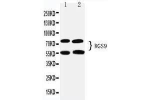 Anti-RGS9 antibody, Western blotting Lane 1: Rat Brain Tissue Lysate Lane 2: Mouse Brain Tissue Lysate (RGS antibody  (C-Term))