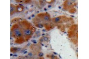 IHC-P analysis of Liver tissue, with DAB staining. (Clusterin antibody  (AA 227-447))