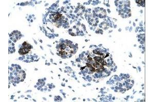 Image no. 1 for anti-Ligase IV, DNA, ATP-Dependent (LIG4) (AA 275-324) antibody (ABIN202951) (LIG4 antibody  (AA 275-324))