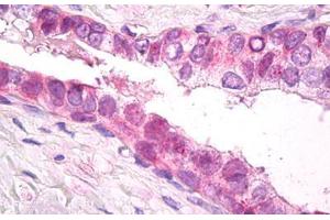 Immunohistochemistry (IHC) image for anti-Proteasome (Prosome, Macropain) 26S Subunit, Non-ATPase, 11 (PSMD11) (AA 288-317) antibody (ABIN1103824)