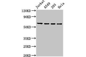 Western Blot Positive WB detected in: Jurkat whole cell lysate, A549 whole cell lysate, 293 whole cell lysate, Hela whole cell lysate All lanes: TAF15 antibody at 8. (TAF15 antibody  (AA 93-206))