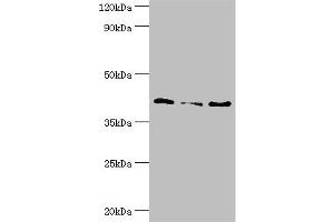 Western blot All lanes: Serpin B5 antibody at 10 μg/mL Lane 1: HepG2 whole cell lysate Lane 2: Hela whole cell lysate Lane 3: A431 whole cell lysate Secondary Goat polyclonal to rabbit IgG at 1/10000 dilution Predicted band size: 43, 26 kDa Observed band size: 43 kDa (SERPINB5 antibody  (AA 21-189))