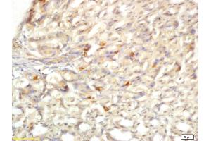 Formalin-fixed and paraffin embedded mouse stomach labeled with Anti-TLR6/CD286 Polyclonal Antibody, Unconjugated (ABIN749573) at 1:200 followed by conjugation to the secondary antibody and DAB staining.