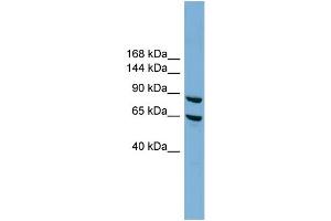 WB Suggested Anti-EXOC6 Antibody Titration: 0. (EXOC6 antibody  (N-Term))