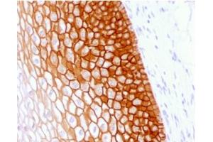 anti-CD44v4 antibody