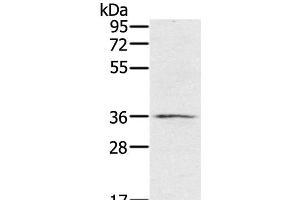 Western Blot analysis of TM4 cell using p53RFP Polyclonal Antibody at dilution of 1:400 (RNF144B antibody)