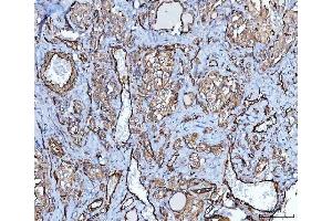 IHC analysis of PTRF/CAVIN1 using anti-PTRF/CAVIN1 antibody (ABIN7601817).