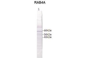 Western Blotting (WB) image for anti-RAB4B, Member RAS Oncogene Family (RAB4B) (Middle Region) antibody (ABIN2788152) (RAB4B antibody  (Middle Region))