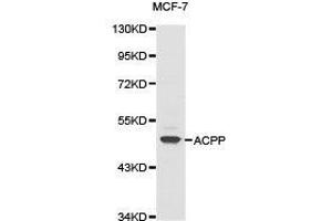 Western Blotting (WB) image for anti-Acid Phosphatase, Prostate (ACPP) antibody (ABIN1870774) (ACPP antibody)