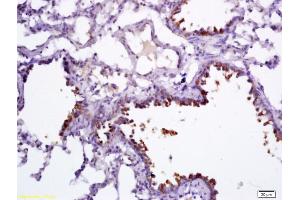 Formalin-fixed and paraffin embedded rat lung labeled with Anti-CC16/CCSP Polyclonal Antibody, Unconjugated (ABIN687262) followed by conjugation to the secondary antibody and DAB staining