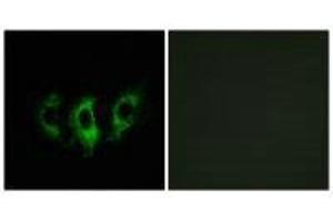 Immunofluorescence analysis of A549 cells, using GFM2 antibody. (GFM2 antibody)