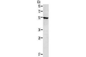 Gel: 8 % SDS-PAGE, Lysate: 40 μg, Lane: A172 cells, Primary antibody: ABIN7192889(TRIM22 Antibody) at dilution 1/250, Secondary antibody: Goat anti rabbit IgG at 1/8000 dilution, Exposure time: 3 minutes (TRIM22 antibody)