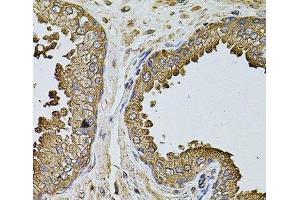 Immunohistochemistry of paraffin-embedded Human prostate using MTIF3 Polyclonal Antibody at dilution of 1:100 (40x lens). (MTIF3 antibody)