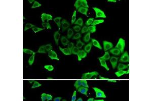 Immunofluorescence analysis of U2OS cells using SGCD Polyclonal Antibody (SGCD antibody)
