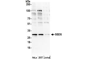 Western Blotting (WB) image for anti-Shwachman-Bodian-Diamond Syndrome (SBDS) (AA 175-225) antibody (ABIN7450730)