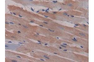 DAB staining on IHC-P; Samples: Rat Heart Tissue (CCL9 antibody  (AA 27-117))