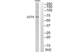 Western blot analysis of extracts from HepG2 cells, using CCT5 antibody. (CCT5 antibody  (Internal Region))