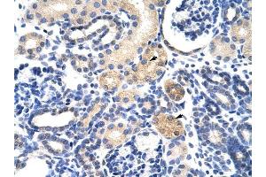 EMG1 antibody was used for immunohistochemistry at a concentration of 4-8 ug/ml to stain Epithelial cells of renal tubule (arrows) in Human Kidney.