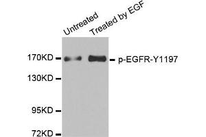 Western Blotting (WB) image for anti-Epidermal Growth Factor Receptor (EGFR) (pTyr1197) antibody (ABIN1870128) (EGFR antibody  (pTyr1197))