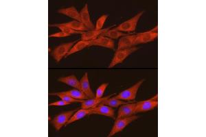 Immunofluorescence analysis of NIH/3T3 cells using CSNK2 Rabbit pAb (ABIN3022252, ABIN3022253, ABIN3022254 and ABIN6218695) at dilution of 1:100 (40x lens). (CSNK2A2 antibody  (AA 1-350))