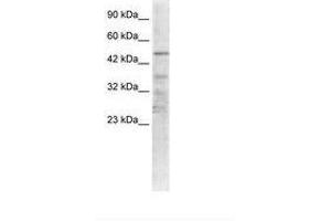 Image no. 1 for anti-Acetylcholine Receptor Subunit alpha (CHRNA1) (AA 25-74) antibody (ABIN6735455) (CHRNA1 antibody  (AA 25-74))