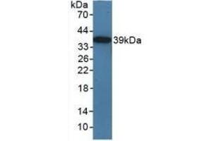 Detection of Recombinant TICAM1, Mouse using Polyclonal Antibody to Toll Like Receptor Adaptor Molecule 1 (TICAM1) (TICAM1 antibody  (AA 263-526))