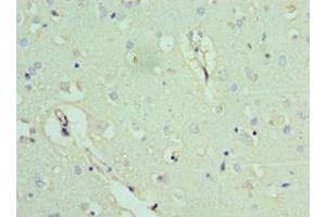 Immunohistochemistry of paraffin-embedded human brain tissue using ABIN7143053 at dilution of 1:100 (Actin-Like 6B antibody  (AA 1-280))