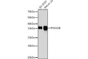 Western blot analysis of extracts of various cell lines, using PHOX2B Rabbit mAb (ABIN7269159) at 1:1000 dilution. (PHOX2B antibody)