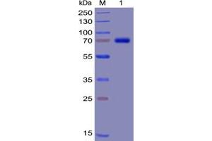 Human TIM3 Protein, mFc-His Tag on SDS-PAGE under reducing condition.