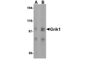 Western blot analysis of Grik1 in rat brain tissue lysate with AP30381PU-N Grik1 antibody at (A) 0.