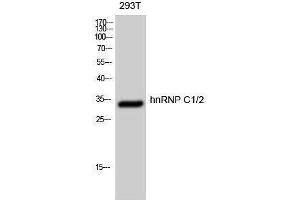 Western Blotting (WB) image for anti-Heterogeneous Nuclear Ribonucleoprotein C (C1/C2) (HNRNPC) (Ser484) antibody (ABIN3185059) (HNRNPC antibody  (Ser484))