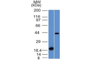 Western Blot Analysis (A) Recombinant Protein (B) Human Liver lysate Aurora B Mouse Monoclonal Antibody (AURKB/1521). (Aurora Kinase B antibody  (AA 89-251))