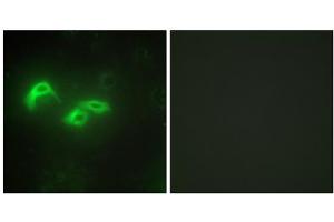 Immunofluorescence analysis of HepG2 cells, using TFAM antibody.