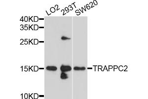 Western blot analysis of extracts of various cell lines, using TRAPPC2 antibody (ABIN4905483) at 1:1000 dilution.
