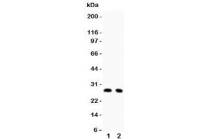Western blot testing of p27KIP1 antibody and Lane 1:  rat thymus (CDKN1B antibody  (AA 10-198))