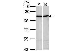 WB Image Sample (30 ug of whole cell lysate) A: A431 , B: Hep G2 , 7. (alpha Actinin 4 antibody)