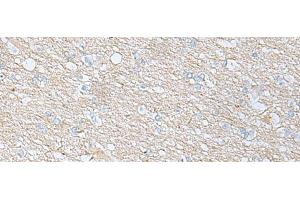 Immunohistochemistry of paraffin-embedded Human brain tissue using BDNF Polyclonal Antibody at dilution of 1:65(x200) (BDNF antibody)