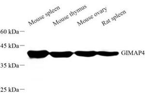 Western blot analysis of GIMAP4 (ABIN7074142) at dilution of 1: 500 (GIMAP4 antibody)
