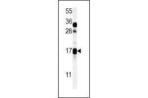 CSAG2 Antibody (N-term) (ABIN651616 and ABIN2840327) western blot analysis in ZR-75-1 cell line lysates (35 μg/lane). (CSAG2 antibody  (N-Term))