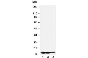 Western blot testing of BAFF-R antibody and Lane 1:  recombinant human protein 10ng (TNFRSF13C antibody  (N-Term))
