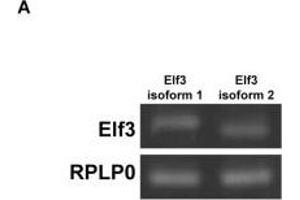 Elf3 overexpression enhanced basal and vasopressin-induced AQP2 promoter activity and transcription. (ELF3 antibody  (AA 1-280))