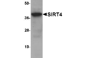 Western blot analysis of SIRT4 in human liver tissue lysate with SIRT4 antibody at 1 µg/mL. (SIRT4 antibody  (N-Term))
