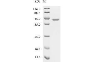 Aldolase A, Fructose-Bisphosphate (ALDOA) (AA 2-364), (full length) protein (His tag,MYC tag)