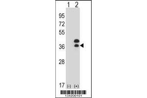 Western blot analysis of DLX5 using rabbit polyclonal DLX5 Antibody using 293 cell lysates (2 ug/lane) either nontransfected (Lane 1) or transiently transfected (Lane 2) with the DLX5 gene. (DLX5 antibody  (AA 100-128))