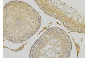 ABIN6279276 at 1/100 staining RAT testis tissue by IHC-P. (CEP41 antibody  (Internal Region))