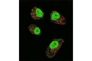 Confocal immunofluorescent analysis of HIF1A antibody with MDA-MB231 cells followed by Alexa Fluor 488-conjugated goat anti-rabbit lgG (green). (HIF1A antibody  (AA 519-547))