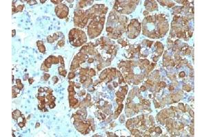IHC testing of FFPE human pituitary gland with ACTH antibody (clone CLIP/1449). (CLIP antibody  (AA 25-39))