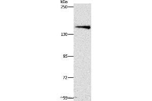 Western blot analysis of Mouse brain tissue, using ARHGEF11 Polyclonal Antibody at dilution of 1:1000 (ARHGEF11 antibody)